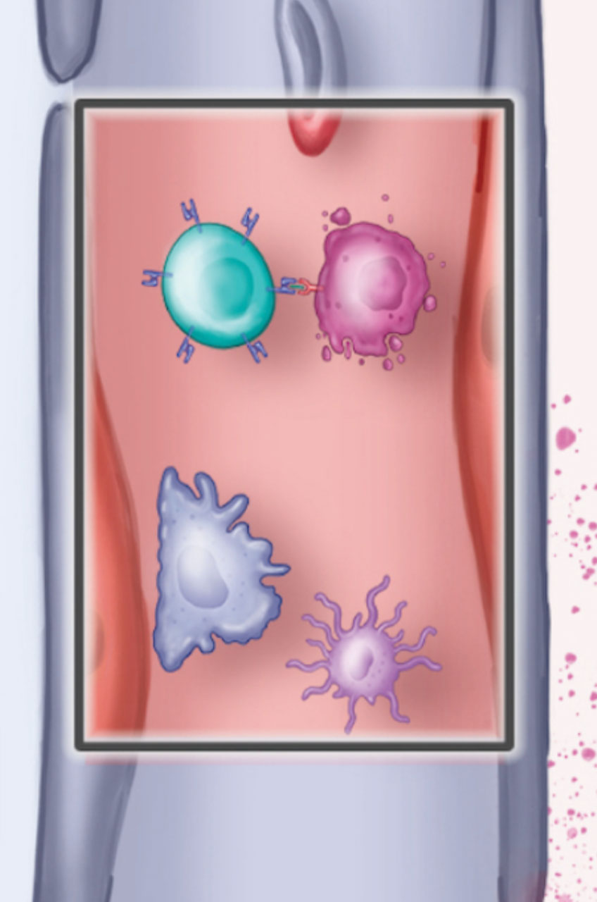 CAR T-cell therapy whitepaper illustration – panel 2