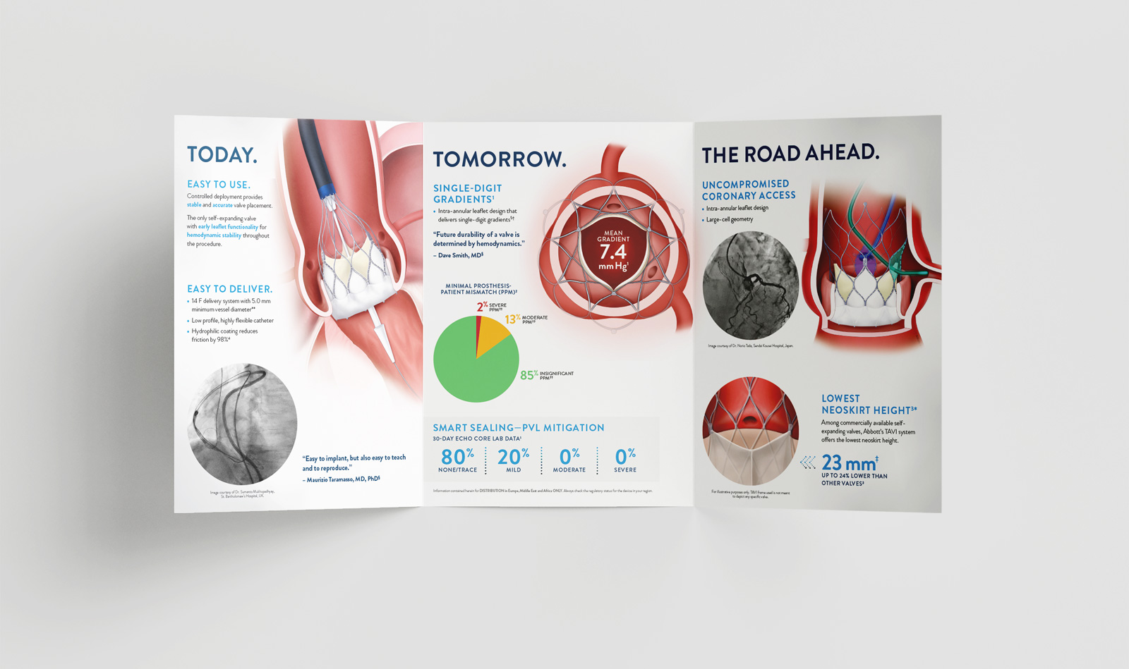 Abbott Navitor TAVI heart valve system brochure medical illustration
