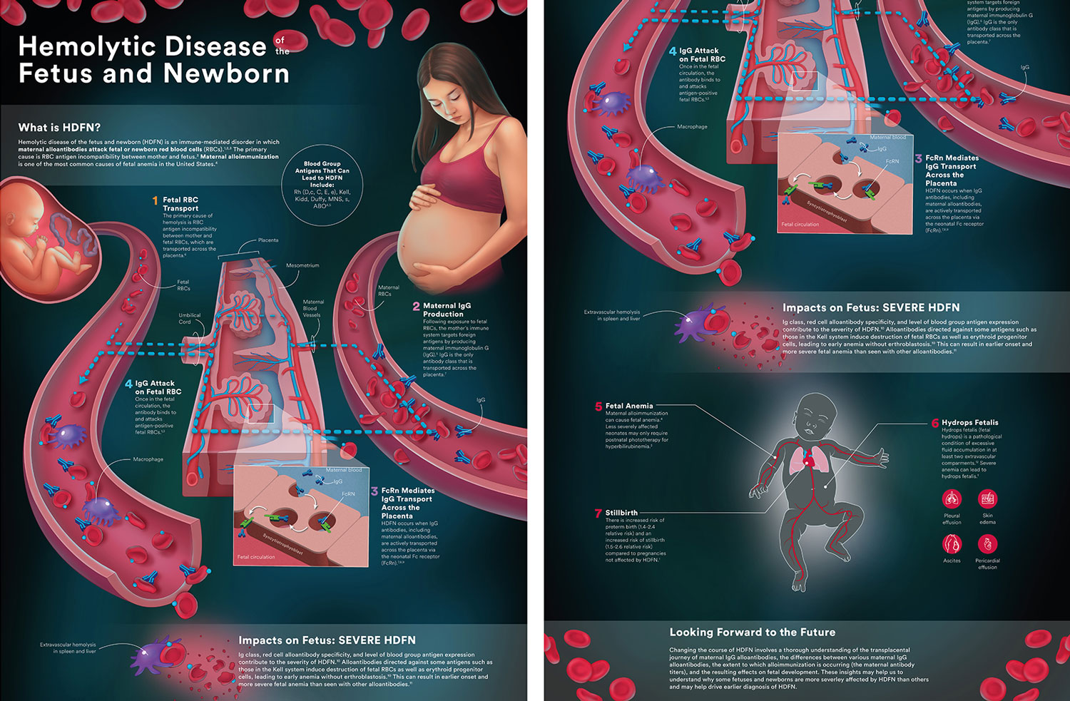 HDFN medical illustration conference banner – close-up detail