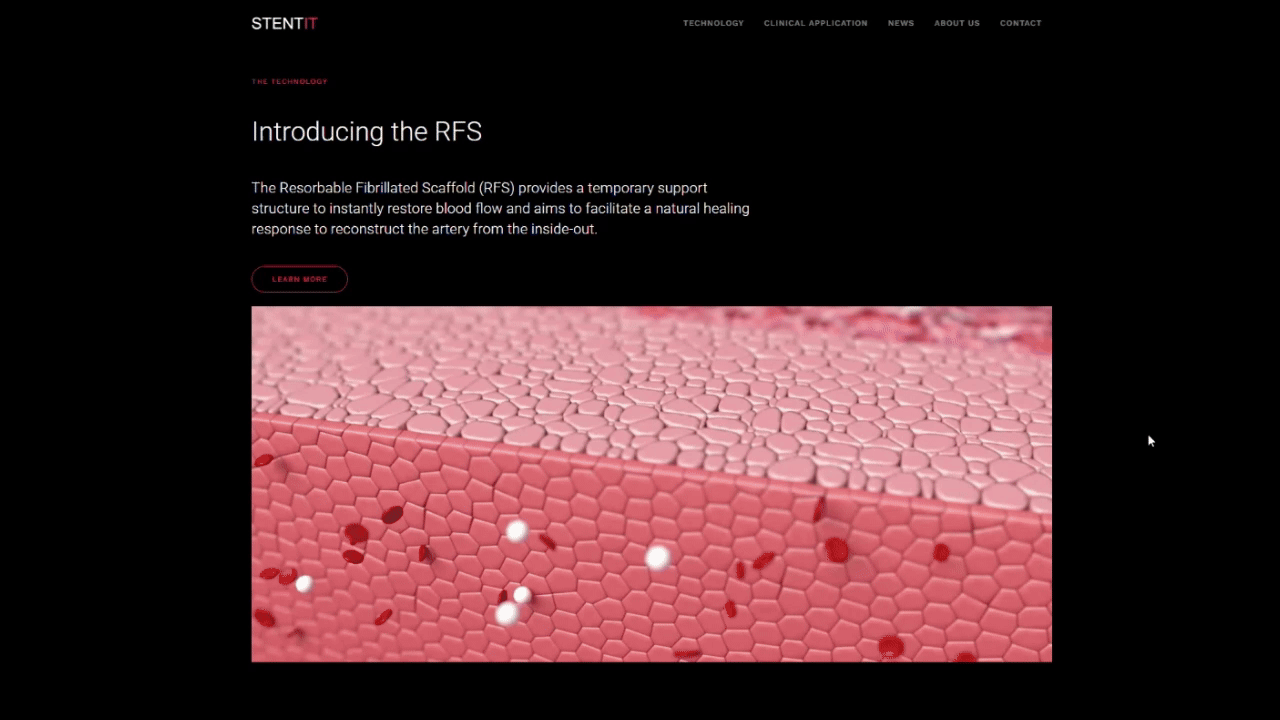 Animated screen capture of Stentit medical device website design
