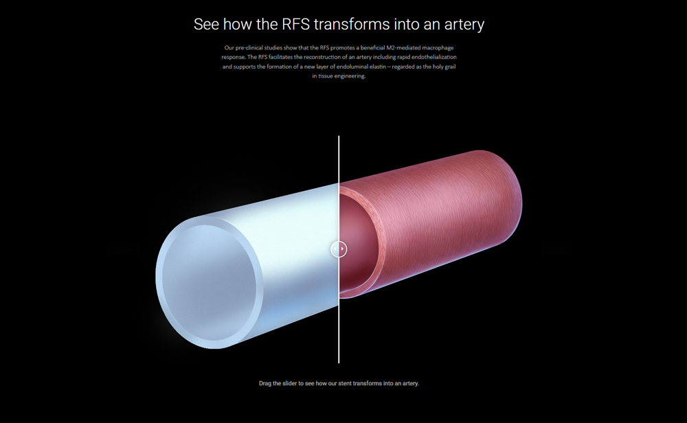 Medical illustration presentation slide