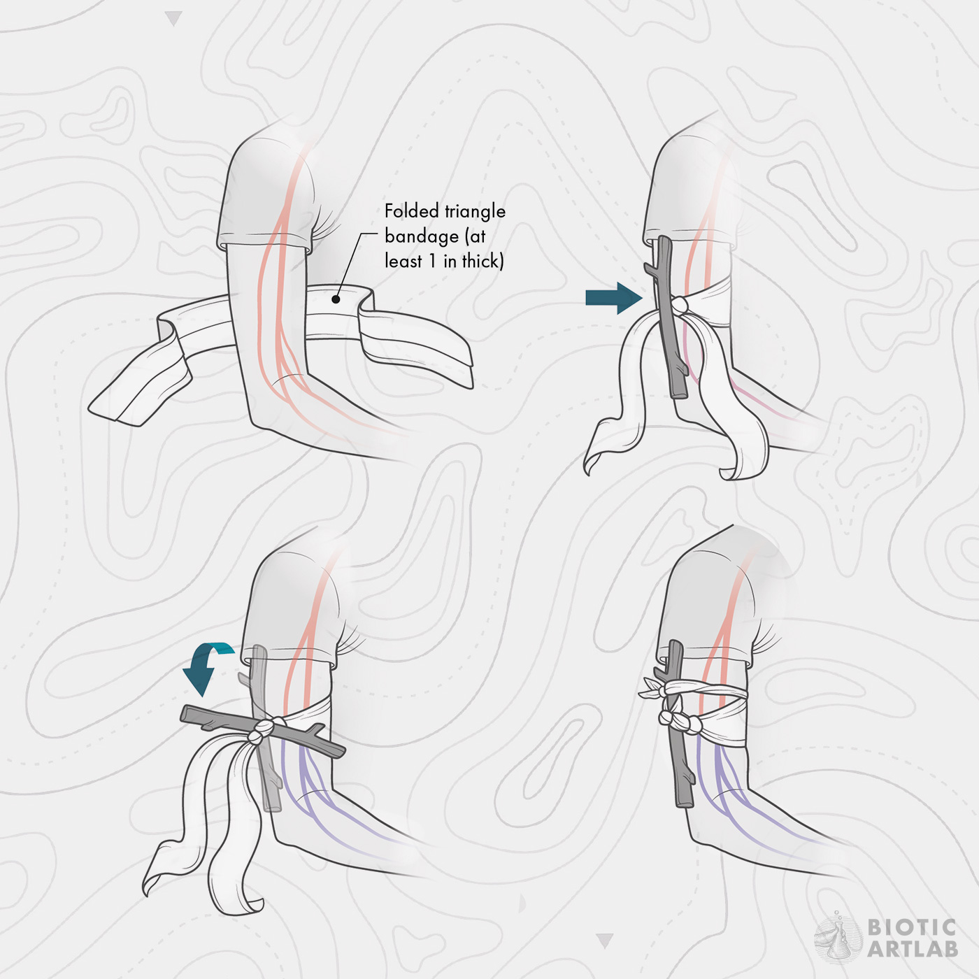 Wilderness first aid emergency treatment medical illustration – scene 2