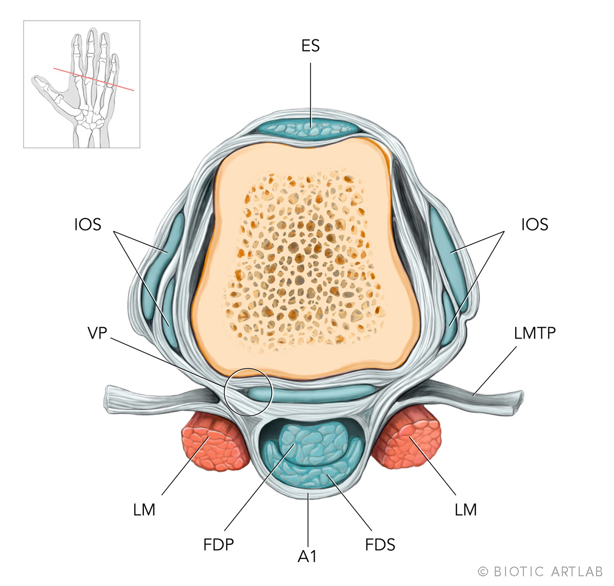 Metacarpophalangeal joint anatomy illustration for rock climbing finger injuries
