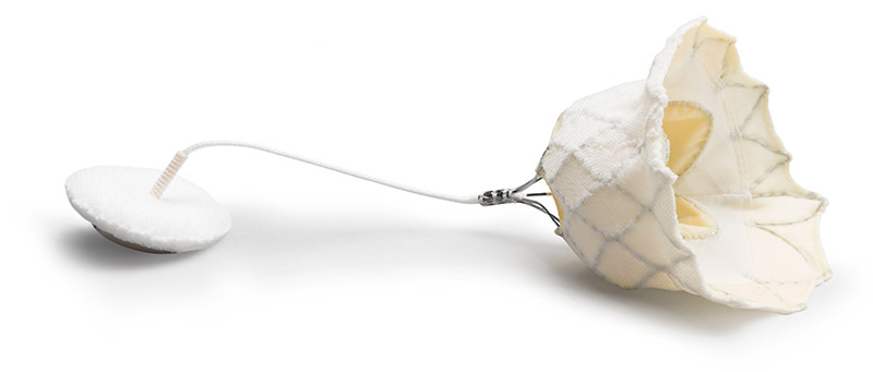 Tendyne transcatheter mitral valve replacement device surgical illustration