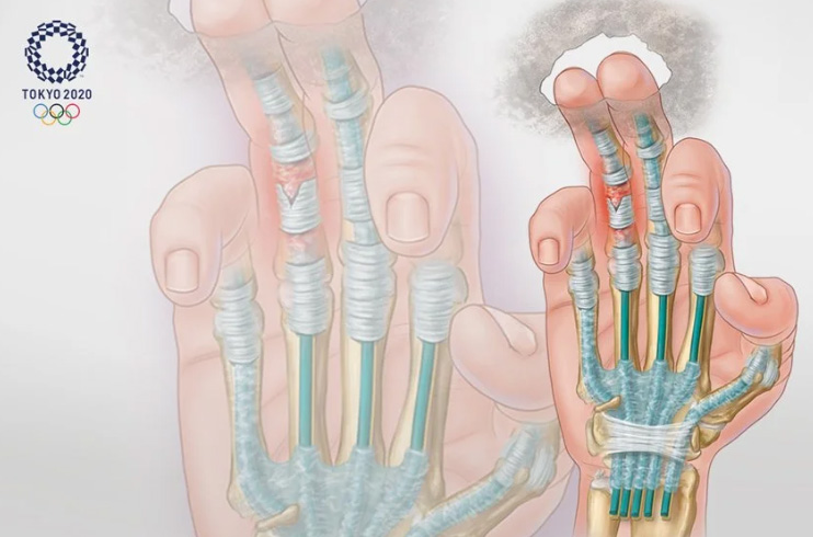Tokyo 2020 Olympic sport climbing medical illustration by Biotic Artlab