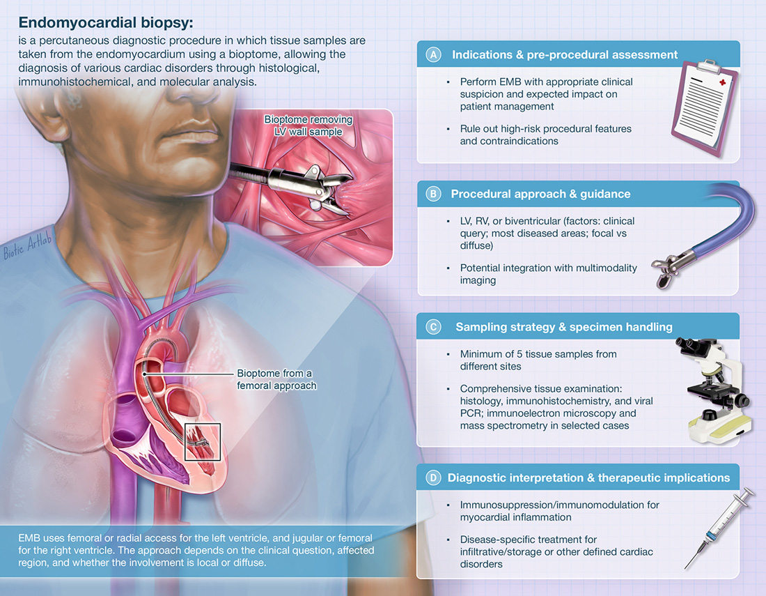 Endomyocardial biopsy procedure Eurointervention Biotic artlab