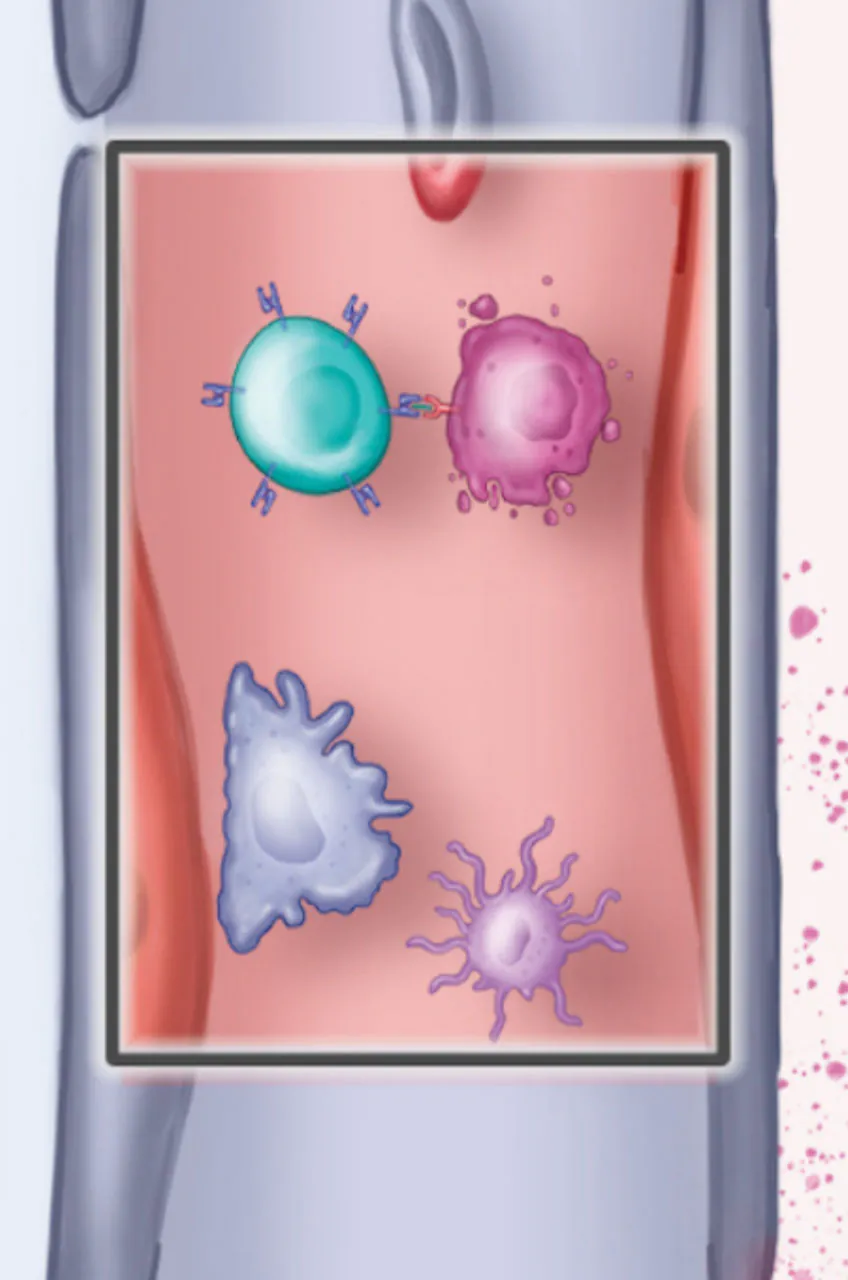 CAR T-cell therapy whitepaper illustration – panel 2