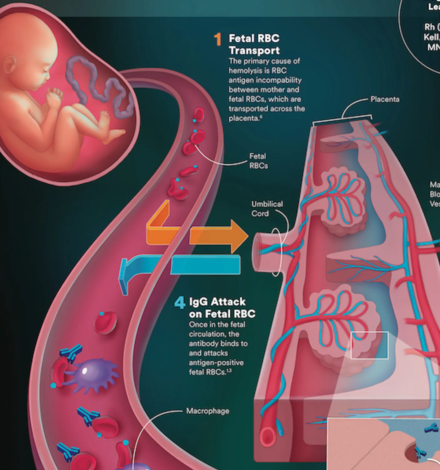 HDFN conference banner header medical illustration by Biotic Artlab