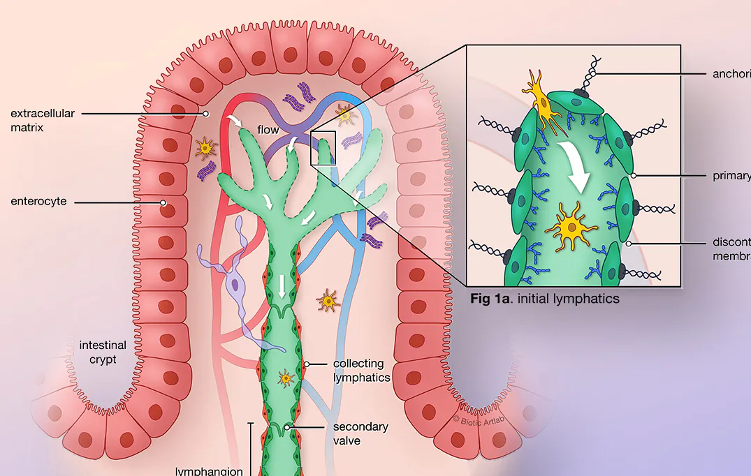 Lymphatic system cancer case study medical illustration